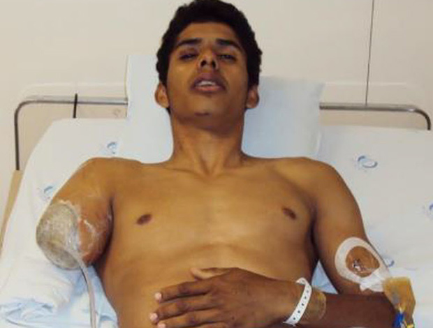 O ciclista David Santos Sousa, que teve o bra&ccedil;o amputado, em leito no Hospital das Cl&iacute;nicas