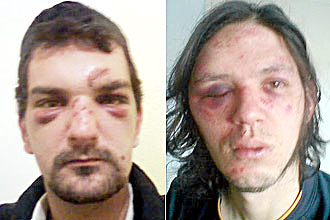 Os brasileiros Márcio Toso (esq.) e Shane Braga, que denunciaram à polícia terem sido agredidos e roubados em Bristol, na Inglaterra