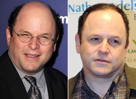 Jason Alexander antes e depois do tratamento capilar