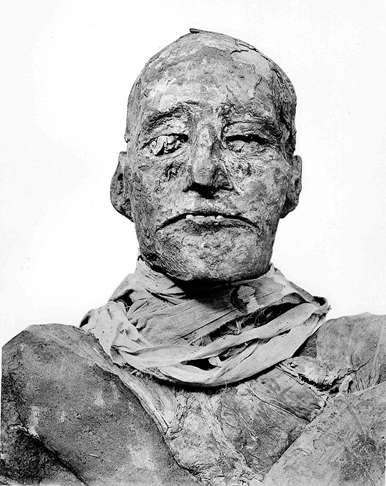 Tomografia inédita revela que faraó Ramsés 3º teve garganta cortada