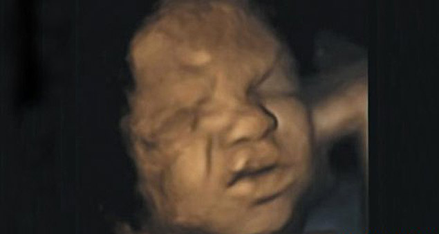 Bebês praticam choro dentro do útero, diz estudo 