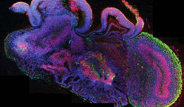 Cientistas criam 'minicérebro humano' em laboratório