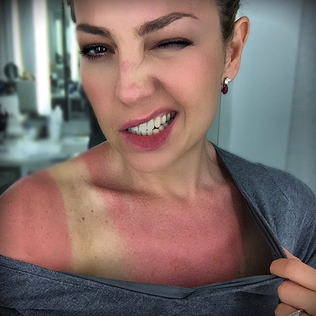 Thalia ganha queimadura após tomar sol da Flórida