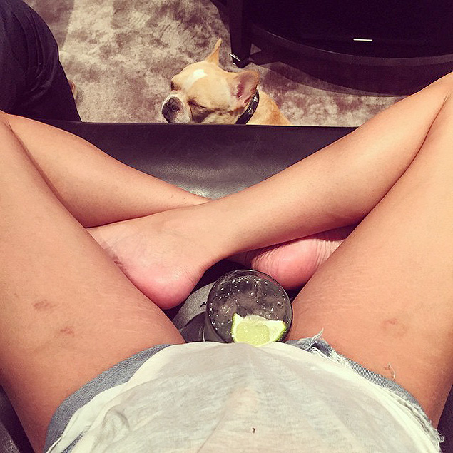 A angel da Victoria&#146;'s Secret Chrissy Teigen publica foto de estrias em sua perna 