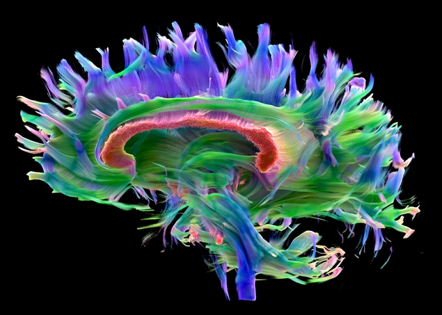 Modelo tridimensional do cérebro mostrando detalhes das conexões nervosas