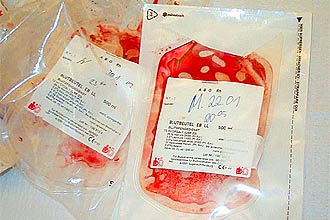 Sangue para transfuso, ao feita para controlar a hemofilia