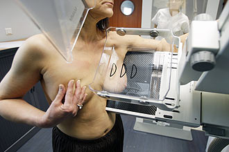 Mulher faz mamografia em Marselha, na França; pesquisadores britânicos apresentam novo tratamento para câncer de mama