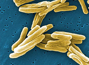 Bacilo de Koch, que causa a tuberculose