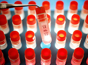 Empresas receberam aval para testes com células-tronco embrionárias em humanos com lesão na medula e cegueira