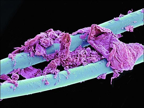 Imagem ampliada em 3-D mostra objetos de uso cotidiano como deste fio dental usado; veja galeria de fotos