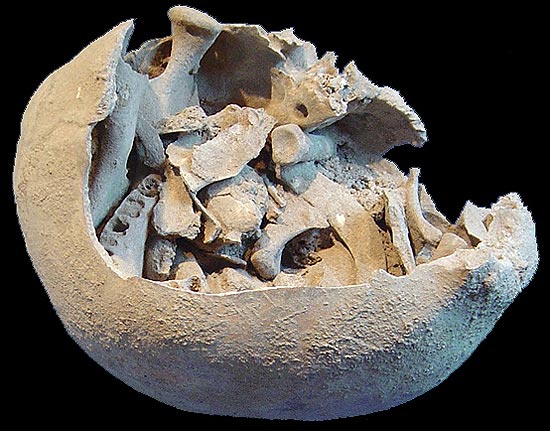 Crnio de indivduo com ossos de outro colocados intencionalmente na cavidade, achado na gruta Lapa do Santo