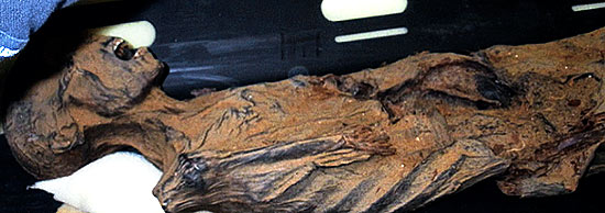 Scanner possibilitou uma tomografia computadorizada da múmia da princesa; ela morreu de aterosclerose