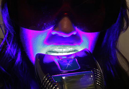 Clareamento de dentes é oferecido em pequenos estabelecimentos franceses; acima, cliente durante tratamento