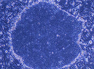 Massa de células-tronco que assumiram estado de embrião