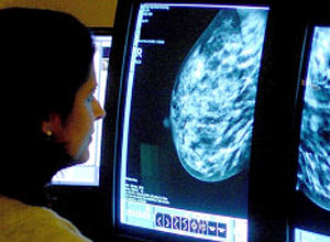 Pesquisadora observa imagem de diagnóstico de um exame de mama