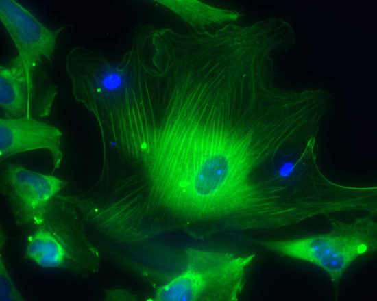 Células musculares derivadas de células-tronco embrionárias humanas