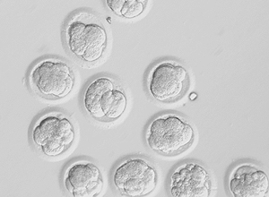 Imagem divulgada pela Oregon University mostra embriões humanos clonados em desenvolvimento 