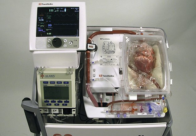 Médicos fazem primeiro transplante com 'coração morto'.