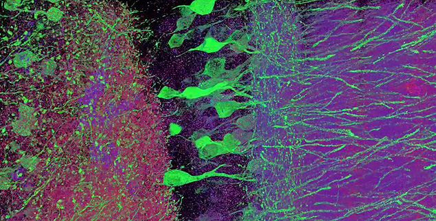 Imagem de neurnios do hipocampo de um camundongo tirada com microscopia de expanso