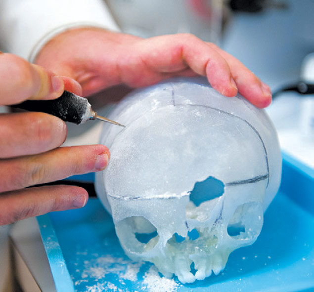 Impresso em 3D utilizada para simulaes pr-operaes cranianas