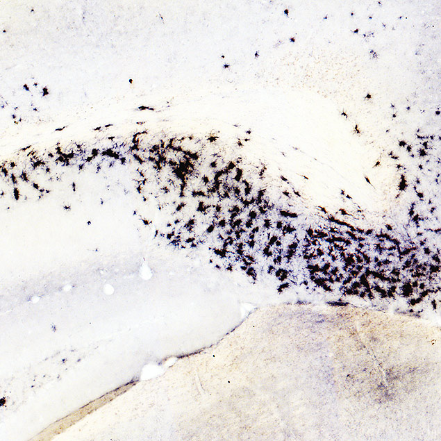 Em modelo animal de alzheimer, clulas do sistema imune ficam ativas (em preto na imagem) e consomem o nutriente chamado arginina