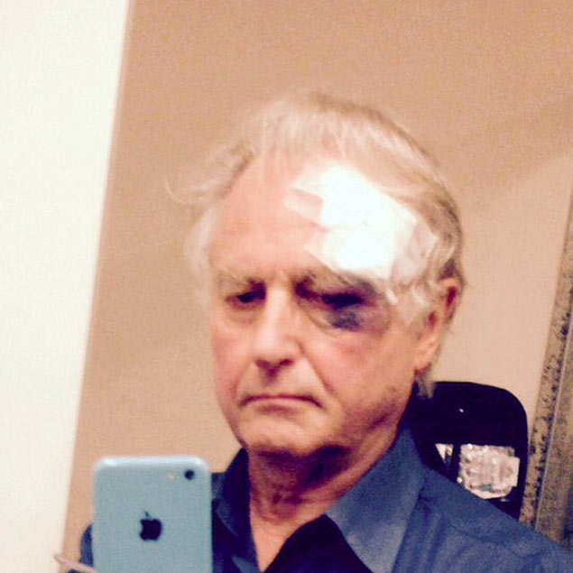Richard Dawkins publica resultado de tombo em aeroporto 