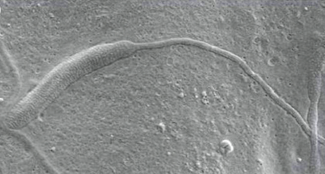 Acredita-se que espermatozide seja o mais antigo j encontrado