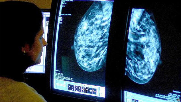 Médica analisa exame de imagem de seio, que pode detectar câncer; lei prevê começo de tratamento em até 60 dias