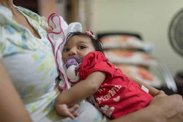 Beb que nasceu com microcefalia no Recife (PE)