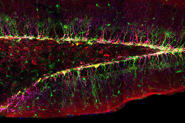 Fatia de cérebro de camundongo recém-nascido contendo células-tronco e neurônios jovens