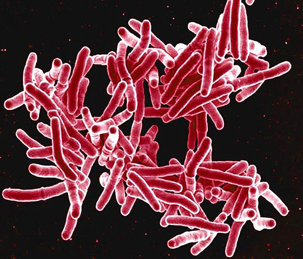 Imagem de microscopia eletrnica mostra a bactria _Mycobacterium tuberculosis_, que provoca tuberculose 