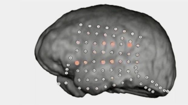 Pesquisadores observaram a atividade em reas do crebro