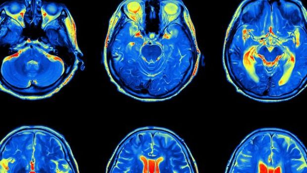 Cientistas querem desvendar relaes entre atividade cerebral e processamento dos sons