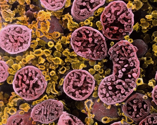 Mitocndrias observadas por meio de microscopia eletrnica e coloridas digitalmente em rosa
