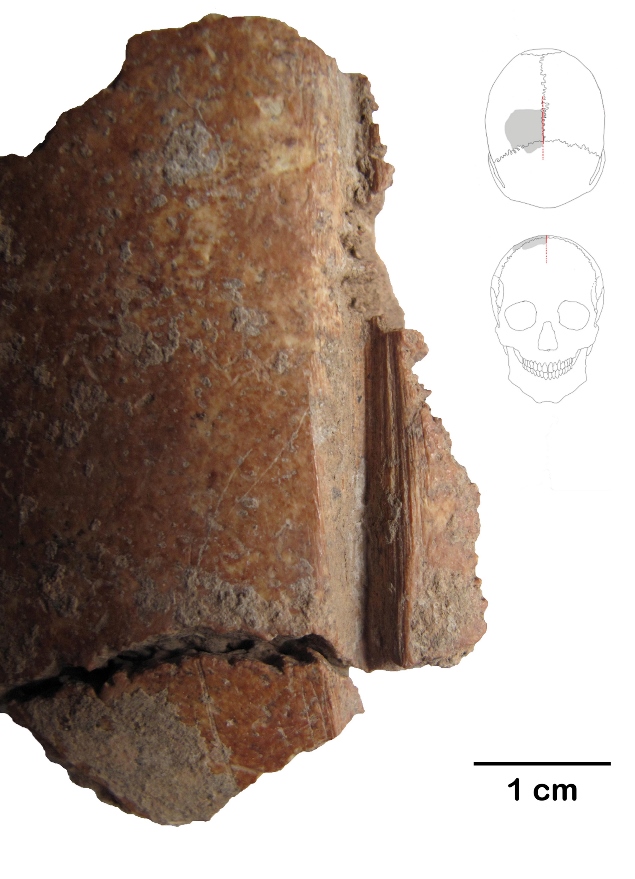 Pedao de crnio que foi marcado com lasca de pedra em antigo 'ritual da caveira'