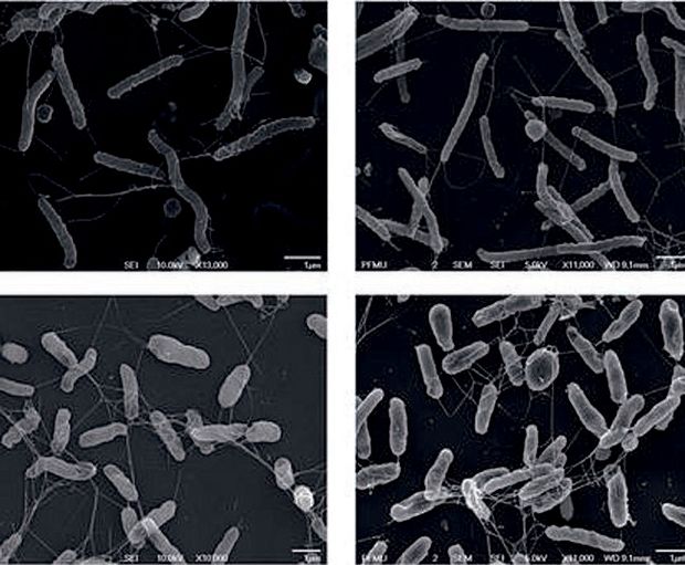 As figuras na parte superior da imagem mostram bactérias normais; as na parte inferior, bactérias depois de introdução de mutação