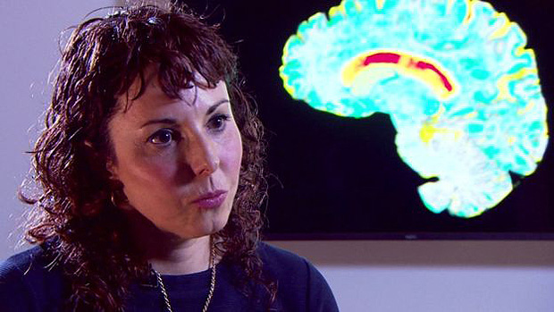 Professora Sarah Tabrizi, do Instituto de Neurologia UCL, liderou os experimentos