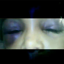 Imagem anexada a denúncia mostra menina de 2 anos com agressões, no Rio de Janeiro