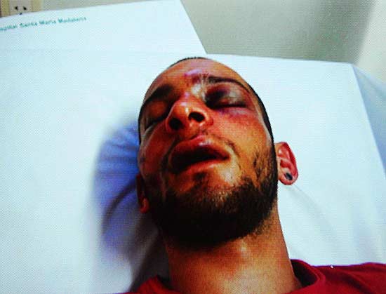 Vítor Suarez Cunha foi agredido após tentar defender mendigo na Ilha do Governador, no RJ