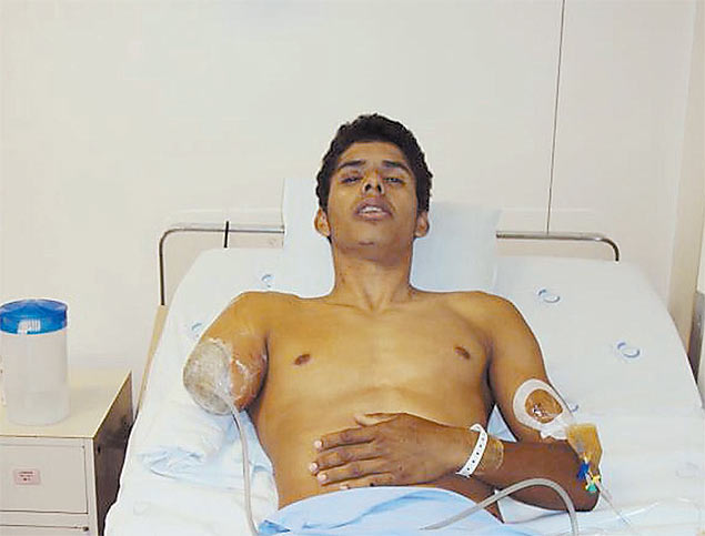 O ciclista David Santos Sousa, 21, que teve o braço decepado, no Hospital das Clínicas