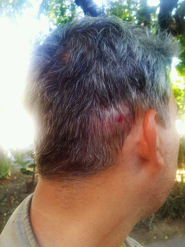 Auxiliar de cinegrafista do SBT fica ferido aps levar garrafada em assalto na regio do Botafogo, zona sul do Rio 