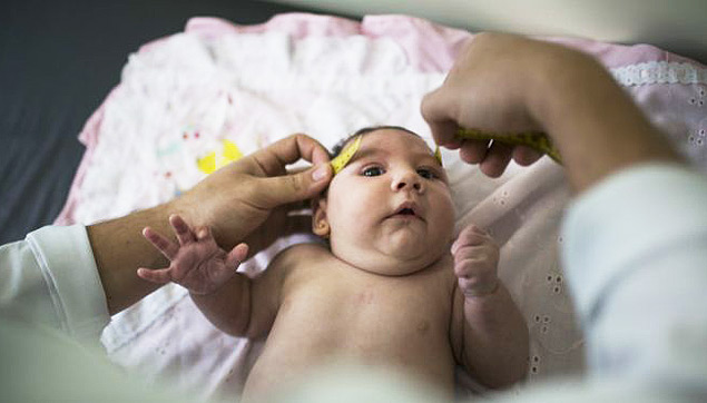 Caso de bebê com microcefalia em Nova York é relacionado com o zika vírus