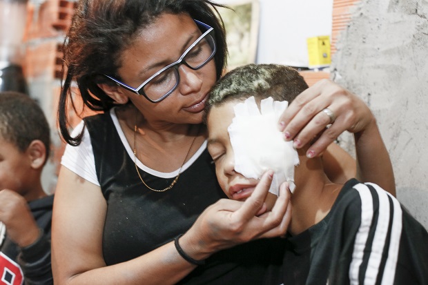 Vanessa Santana e o filho D., 12, que perdeu o olho esquerdo aps ser atingido por uma bala de borracha da PM