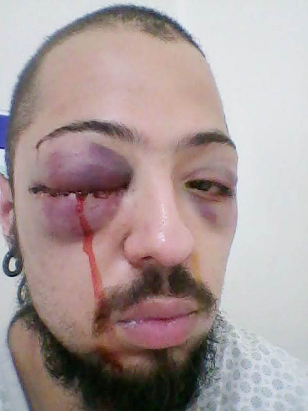Universitrio Adauto Nogueira ferido aps abordagem policial em repblica em Bauru (SP)