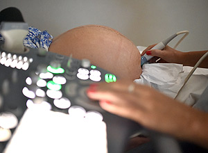 Infant Mortality Rate in Brazil Has Gone up for The First Time Since 1990