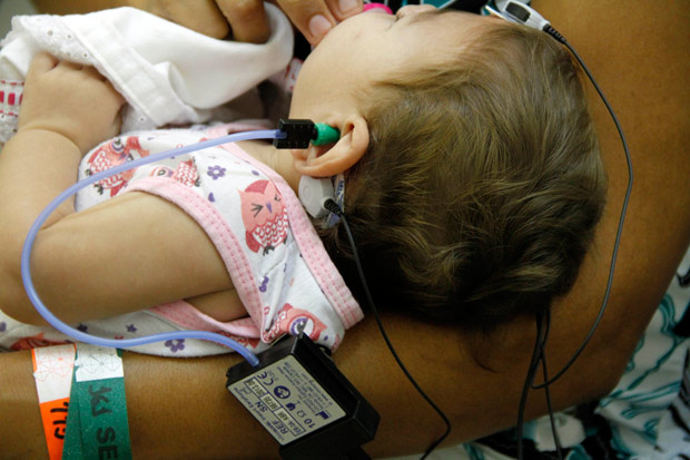 Estudo realizado no Recife identificou que 5,8% das crianças com zika apresentam perda auditiva