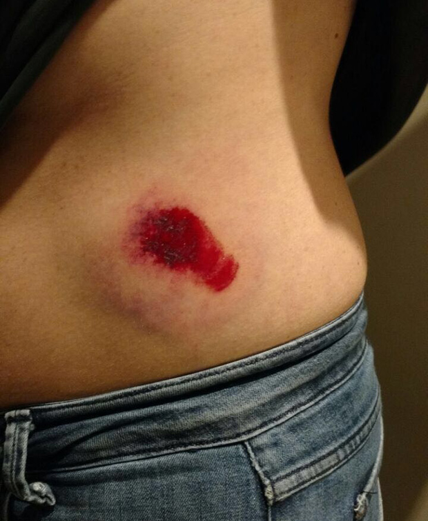 Fotgrafa da Folha Marlene Bergamo fica ferida aps ser atingida por tiro de bala de borracha da Polcia Militar durante ocupao de sem-teto no centro de SP