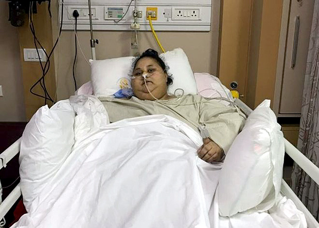 Eman Ahmed Abd El Aty, que chegou a pesar 500 quilos, recupera-se de cirurgia baritrica na ndia 