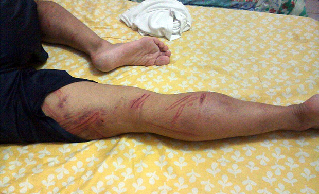 Soldado do Exrcito mostra ferimentos aps sofrer agresses dentro de batalho no Rio de Janeiro