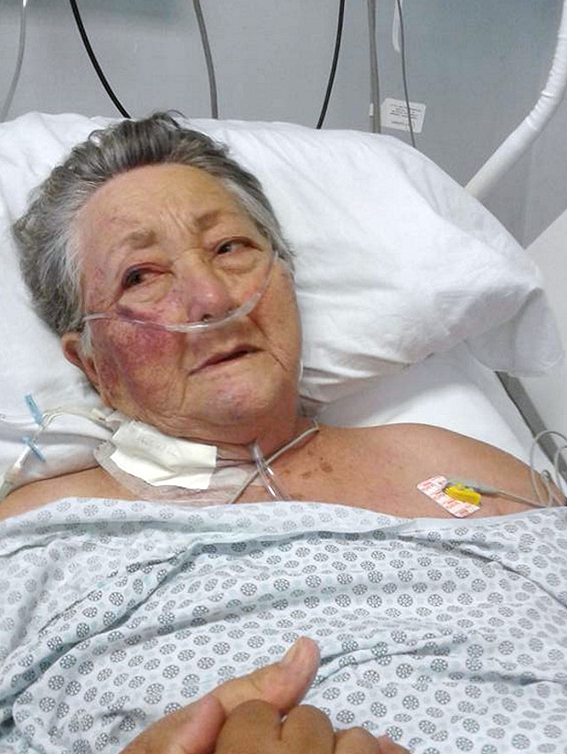 A dona de casa Thereza de Jesus Garcia, 78, com o rosto machucado, no leito da UTI do Hospital do Servidor Pblico Municipal, que abriu sindicncia 